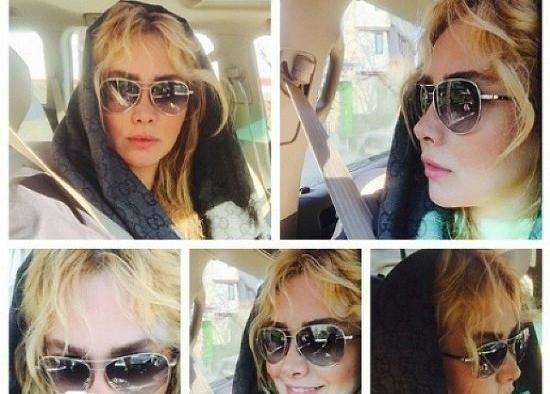 عکسهای آنا نعمتی قبل از عمل