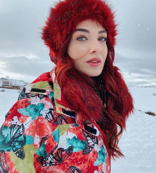 عکس ییلدیز قبل از عمل ستاره شمالی