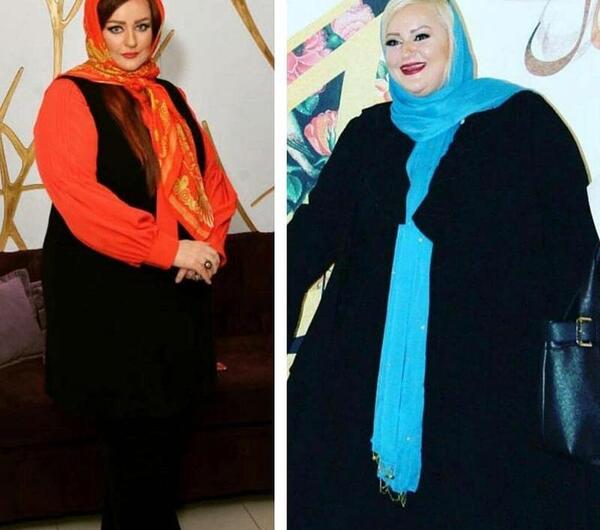 عکس بهاره رهنما قبل عمل