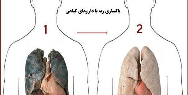 عکس ریه قلیان