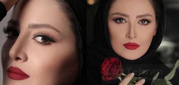 عکس شیلا خداداد قبل عمل زیبایی