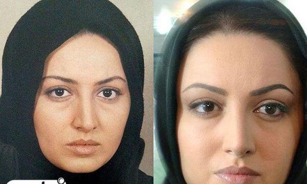 عکس شیلا خداداد قبل عمل زیبایی