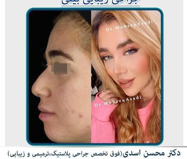 عکس مدل های عمل بینی