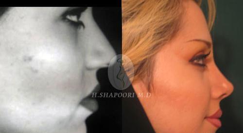 عکس مدل های عمل بینی