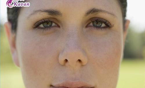 عکس مدل های عمل بینی