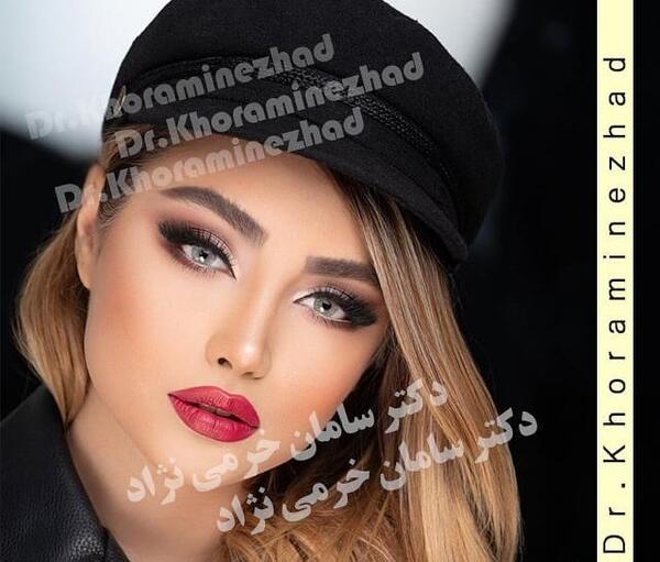 عکس مدل های عمل بینی