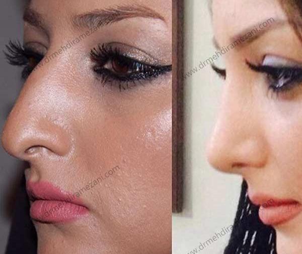 عکس مدل های عمل بینی