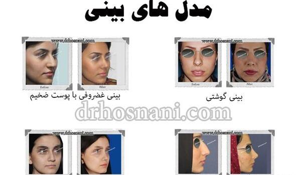عکس مدل های عمل بینی