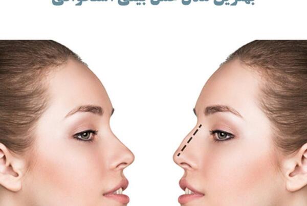عکس مدل های عمل بینی