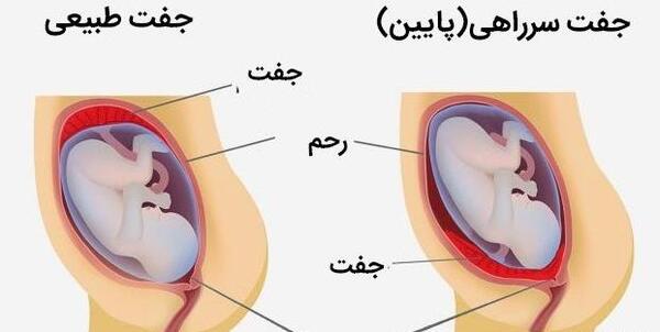 عکس و تصویر جفت فوندال