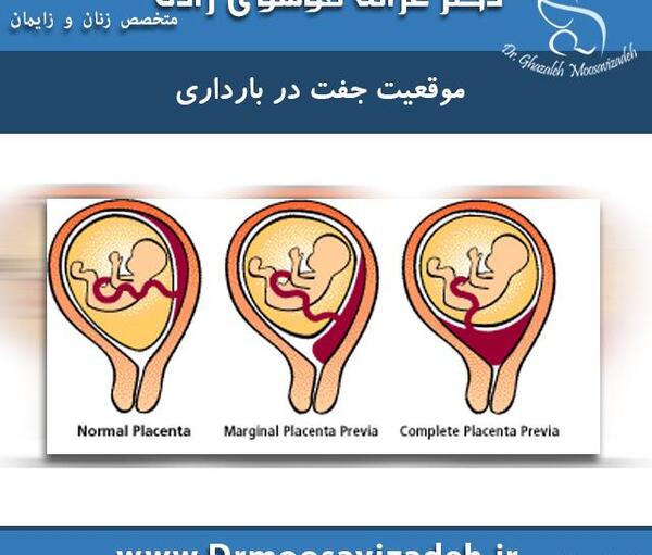عکس و تصویر جفت فوندال