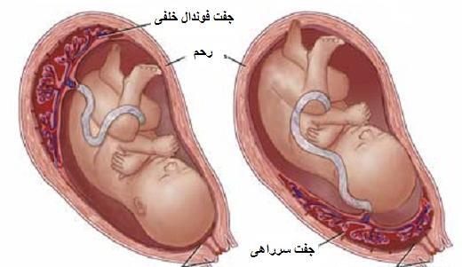 عکس و تصویر جفت فوندال