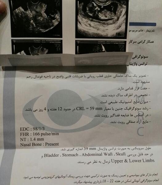 عکس و تصویر جفت فوندال