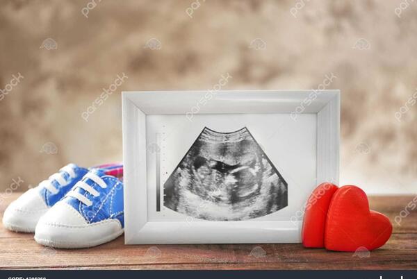 ایده برای عکس سونوگرافی