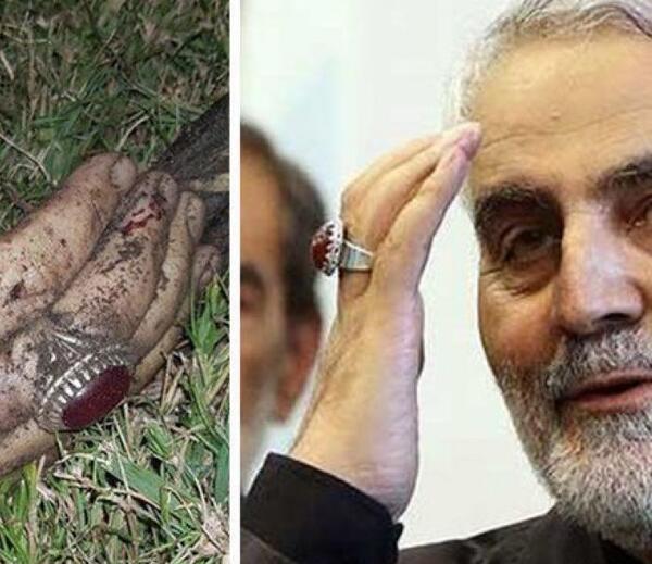 عکس بدن سردار سلیمانی سوخته