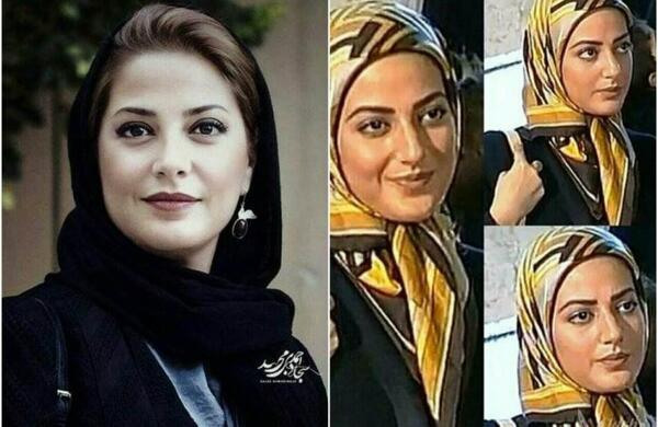 عکس طناز طباطبایی قبل از عمل