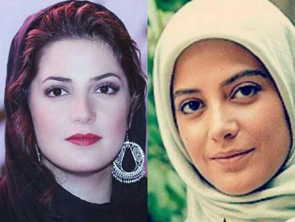 عکس طناز طباطبایی قبل از عمل