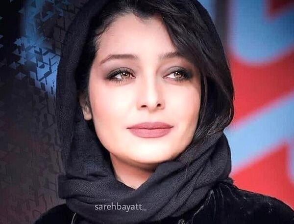 عکس قبل از عمل ساره بیات