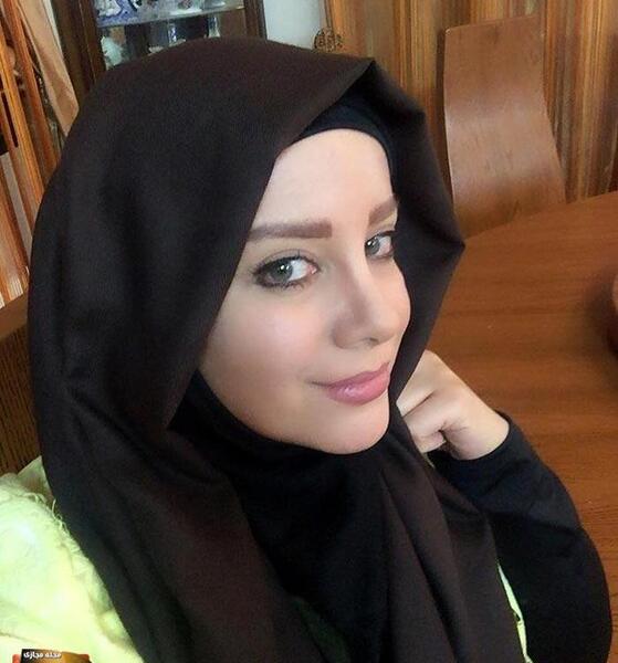عکس شراره رخام با ژل لب