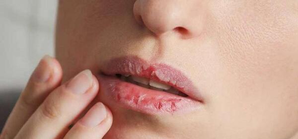 عکس لب ترک خورده