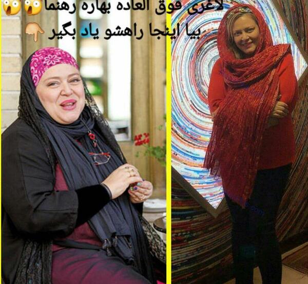 عکس بهاره افشار قبل عمل