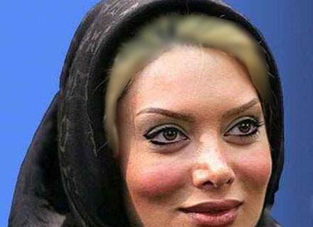 عکس لیندا کیانی قبل از عمل