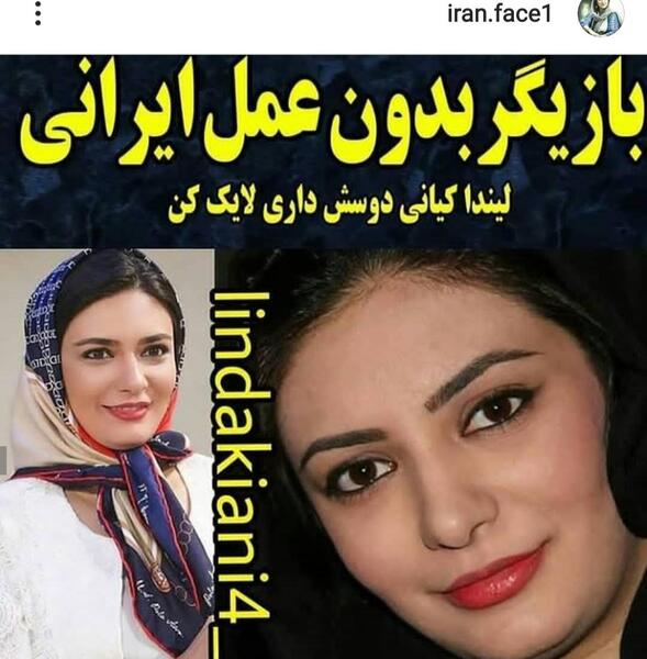 عکس لیندا کیانی قبل از عمل