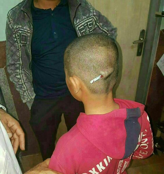 عکس وحشتناک سر