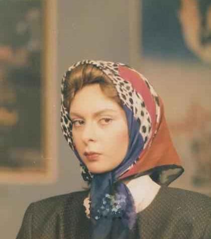 عکسهای افسانه بایگان قبل از عمل