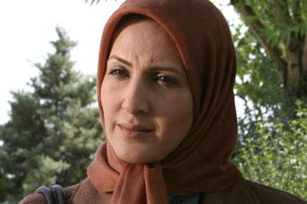 عکس فاطمه گودرزی بعد از عمل زیبایی
