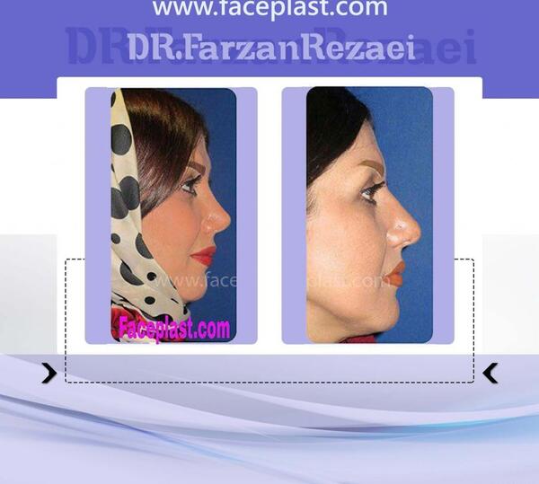 عکس فروزان رضایی