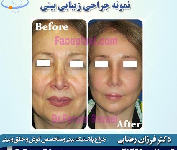 عکس فروزان رضایی