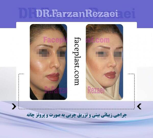 عکس فروزان رضایی