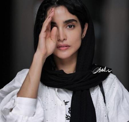 عکس الهه حصاری در زخم کاری