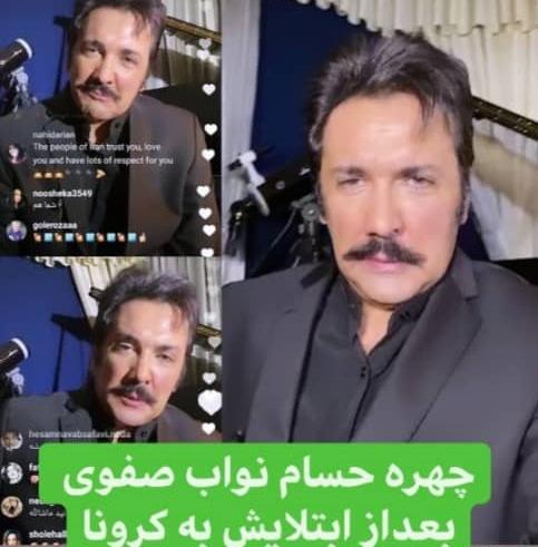 عکس حسام نواب صفوی قبل از عمل بینی