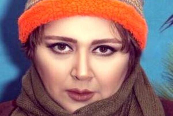 عکس شهره لرستانی قبل عمل بینی