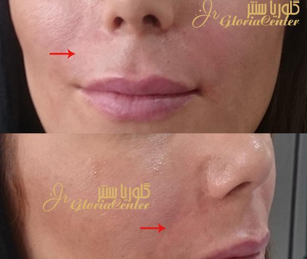 عکس لب در حال خنده