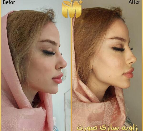 عکسهای مدلینگ صورت