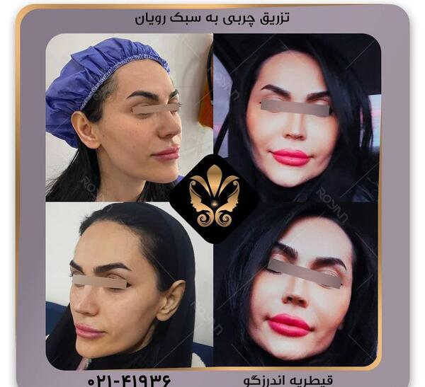 عکسهای مدلینگ صورت