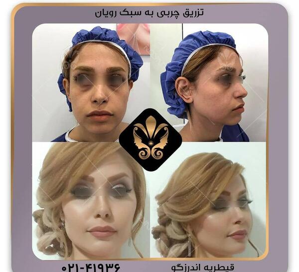 عکسهای مدلینگ صورت