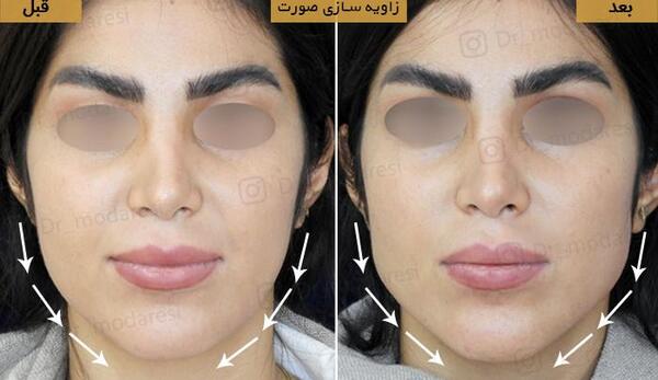 عکسهای مدلینگ صورت