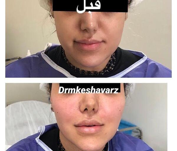 عکسهای مدلینگ صورت