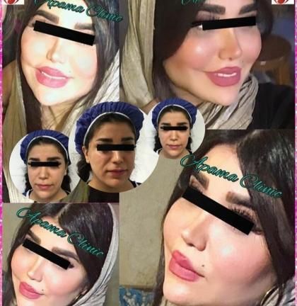 عکسهای مدلینگ صورت
