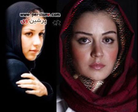 خواهرش عکس افسانه پاکرو قبل از عمل