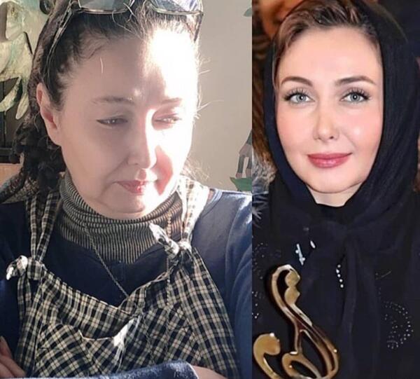 خواهرش عکس افسانه پاکرو قبل از عمل