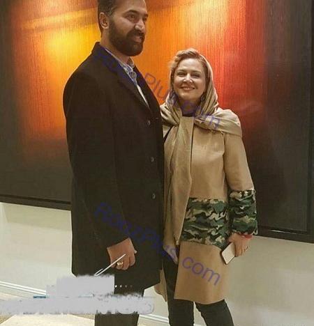 عکس بهاره رهنما بعد از عمل
