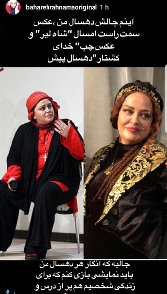 عکس بهاره رهنما بعد از عمل
