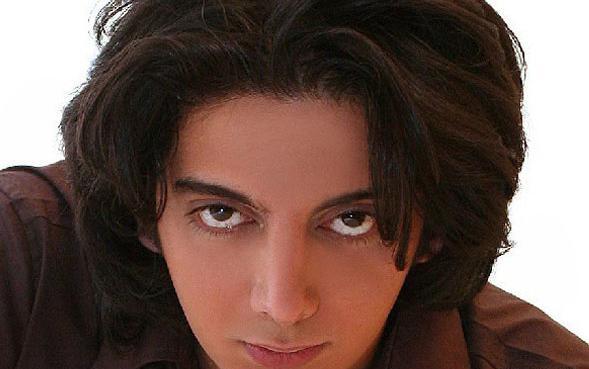 عکس فرزاد فرزین قبل از عمل زیبایی
