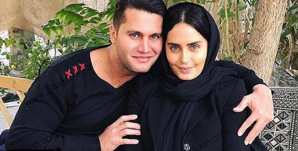 عکس الناز شاکردوست قبل عمل زیبایی