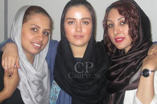 عکس افسانه پاکرو قبل از عمل